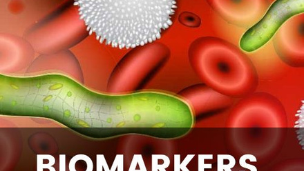 Biomarkers-of-sepsis.jpg
