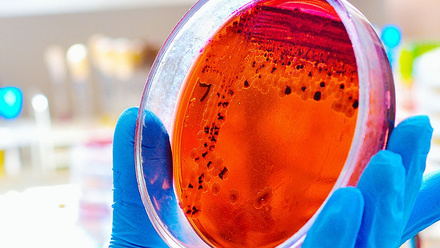 shutterstock_1088873696_microbiology_webbanner.jpg